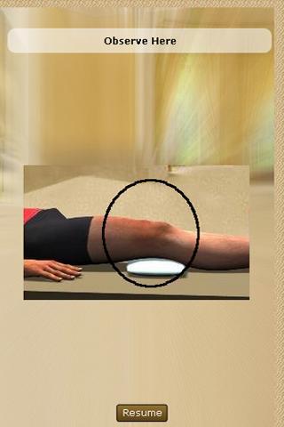 Posterior Cruciate Ligament