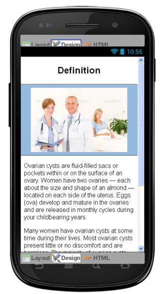 Ovarian Cysts Information