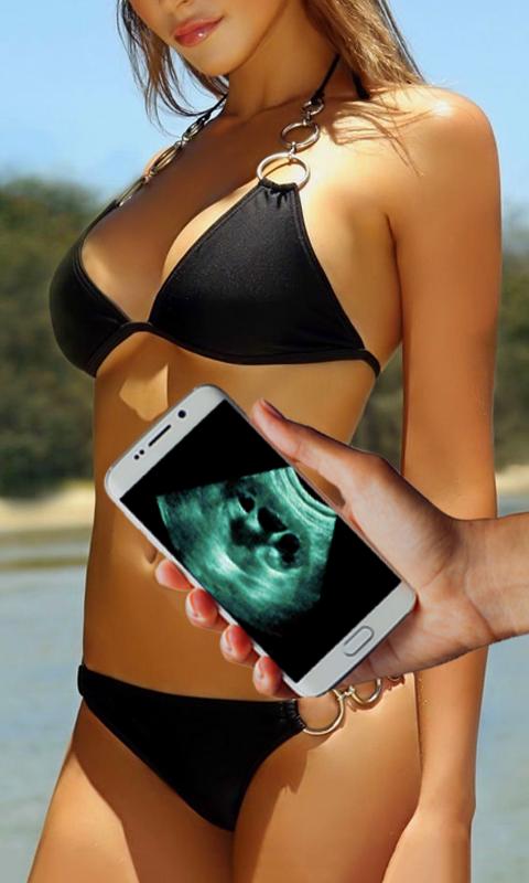 Ultrasound Scanner Prank