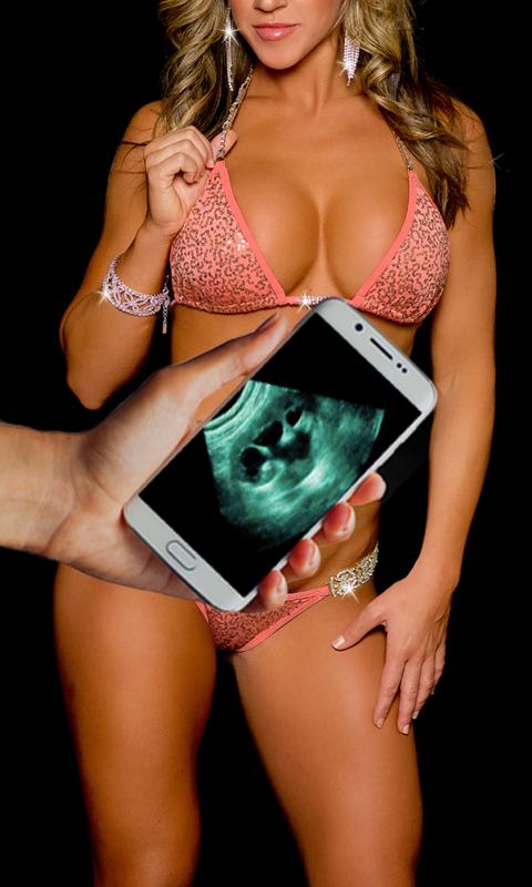 Ultrasound Scanner Prank