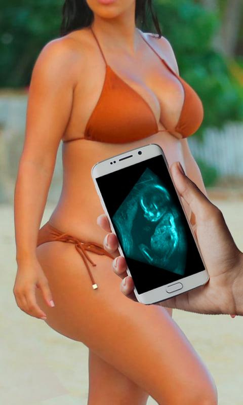 Ultrasound Scanner Prank