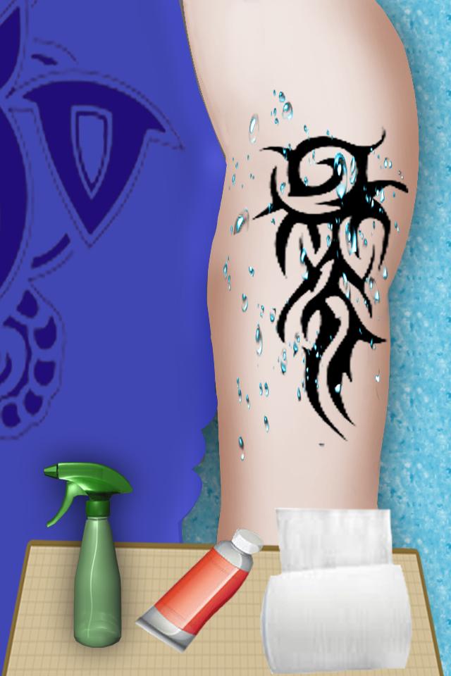 Tatoo Removal Surgery Game