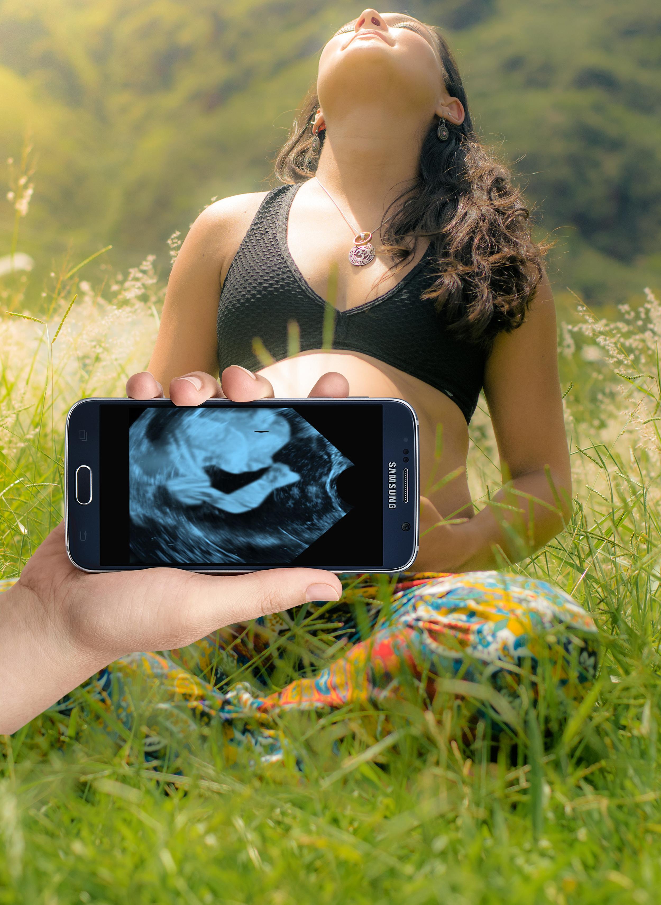 Ultrasound Pregnancy (Prank)